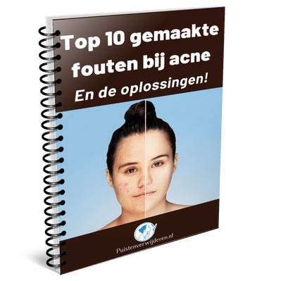 Gratis boek over acne en puistjes